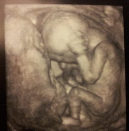 Bebis1